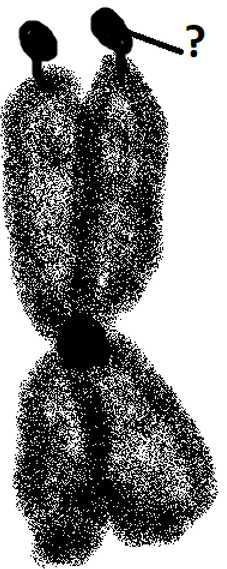 Non-staining secondary constrictions of chromosomes apart from centromere