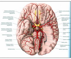 Image: brain blood vessels