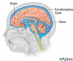 Image: cerebrospinal fluid