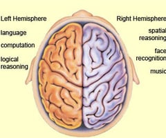 Image: Hemispheres of the brain