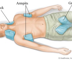 Image: treatment of heat stroke