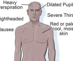 Image: symptoms of heat exhaustion