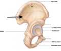 Image: Gluteal lines of pelvic girdle