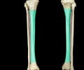 Image: shaft of tibia