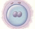 Image: Zygote
