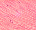 Image: muscle