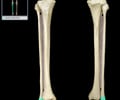Image: lateral malleolus