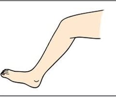 Image: leg