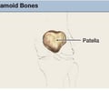 Image: sesamoid bone