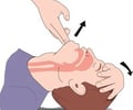 Image: how to open an Airway