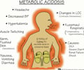 Image: metabolism