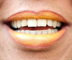 Image: mouth