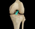 Image: ligament