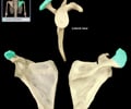 Image: Acromion process