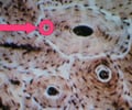 Image: osteocytes
