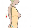 Image: spinal cavity