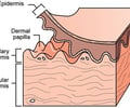 Image: dermis