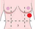 Image: left hypochondriac region