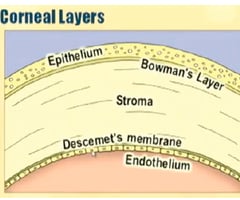 Image: Bowman