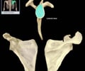 Image: glenoid fossa