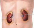 Image: kidney