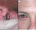 Image: adenovirus