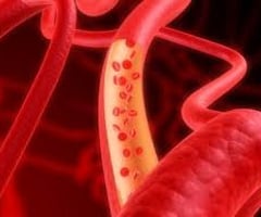 Image: blood vessels