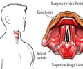 Image: voice box