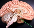 Image: gland