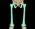 Image: femur