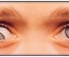 Image: hypotropia
