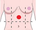 Image: epigastric region