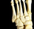 Image: Middle phalanges of the foot