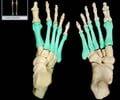 Image: metatarsals
