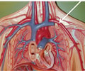 Image: artery