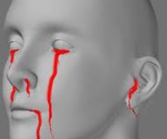 Image: signs of internal bleeding