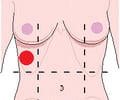 Image: right hypochondriac region