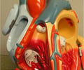 Image: ventricle