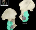 Image: ischium