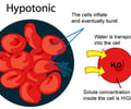 Image: Hypotonic