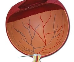 Image: optic nerve