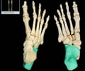 Image: Calcaneus