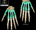 Image: metacarpals