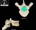Image: Vertebral formen