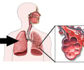 Image: lungs