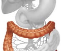 Image: large intestine