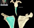 Image: Subscapular fossa