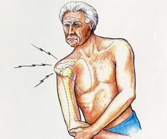 Image: dislocation