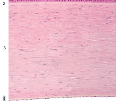 Image: corneal epithelium
