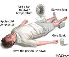 Image: treatment of heat exhaustion